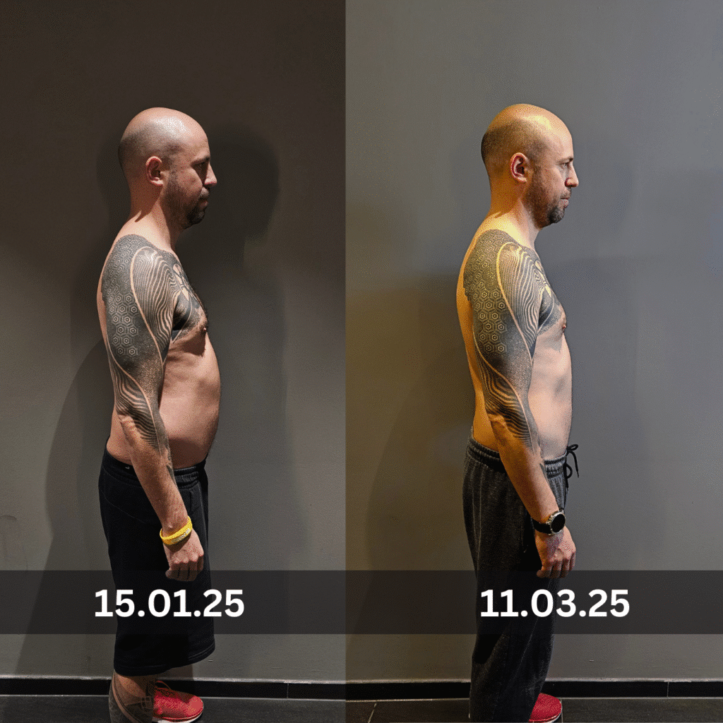 Before & After 2 Monate Transformation Zürich