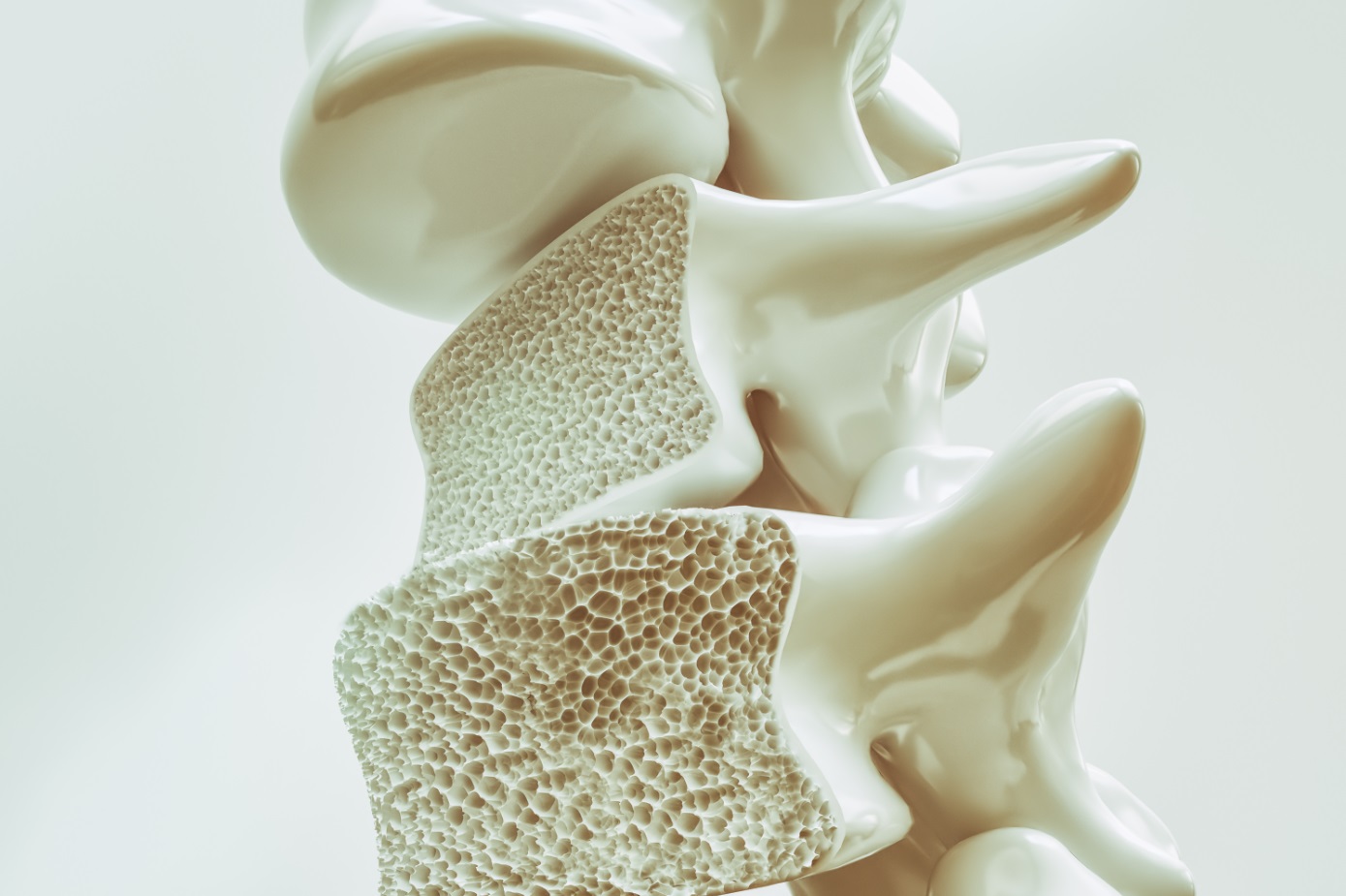 Diagnoseverfahren für Osteoporose